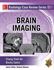 Picture of Brain Imaging Case Review